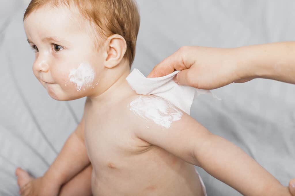 Cuidado de la Piel del Bebé: Guía para Prevenir la Dermatitis del Pañal